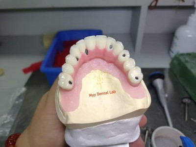 义齿外贸工厂OEM贴牌代加工出口资质齐全 深圳义齿加工厂合作图2